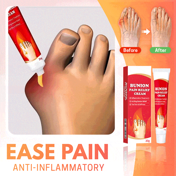 bunion-toe-relief-cream-toe-spacers-fancyberrie-824752_1024x1024@2x.gif